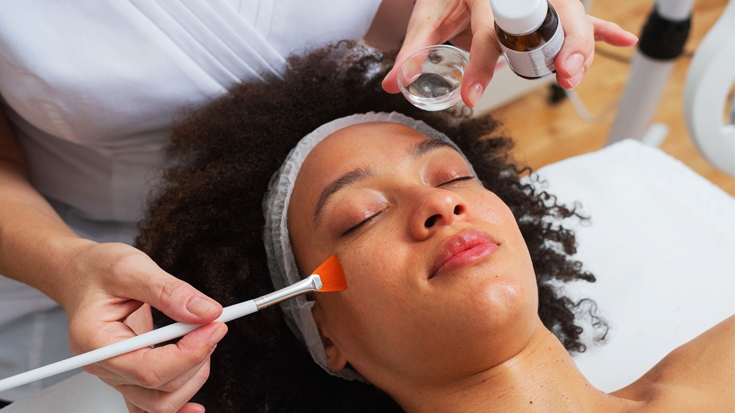 Here Are 3 Surprising Things Chemical Peels Do to Your Skin over